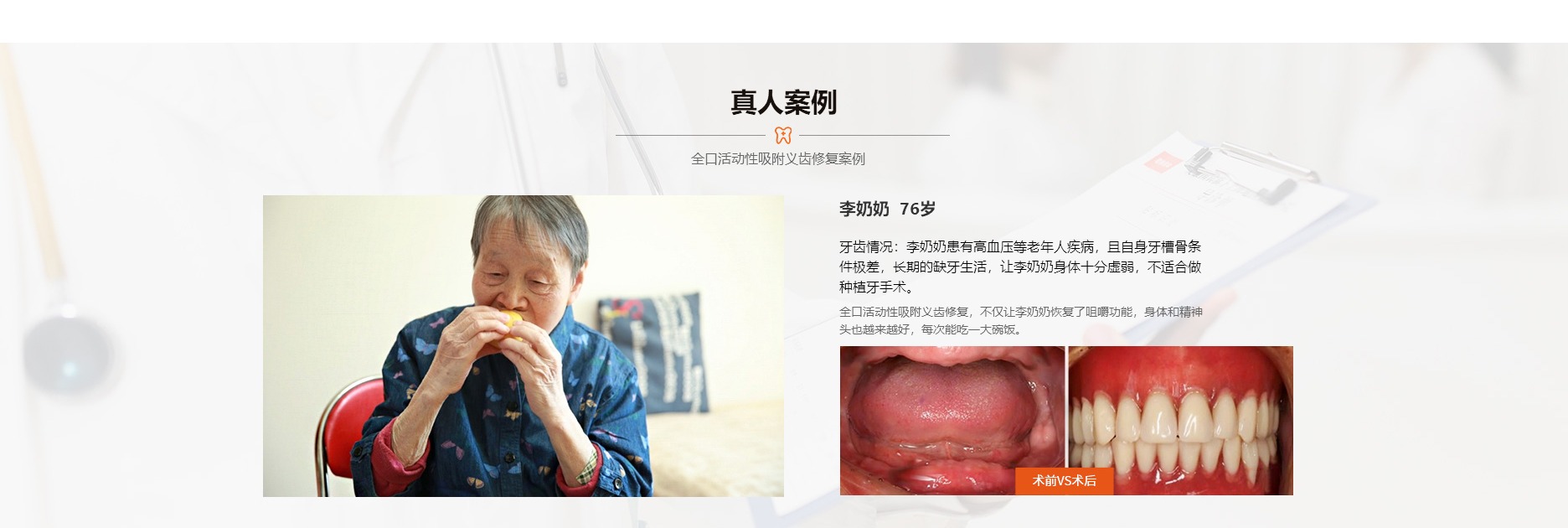 真人案例